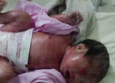 国外单身女性可以做试管吗？