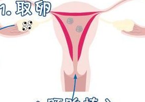 广州优秀机构三代试管婴儿靠谱吗？